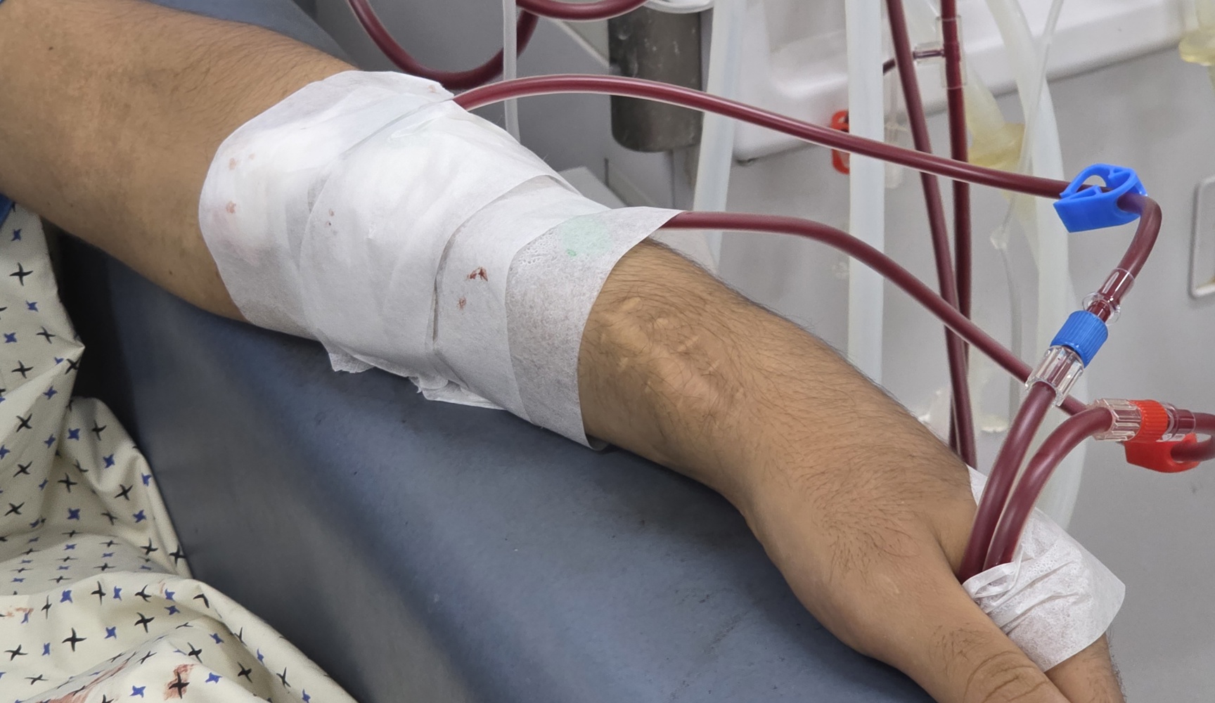 Gauze